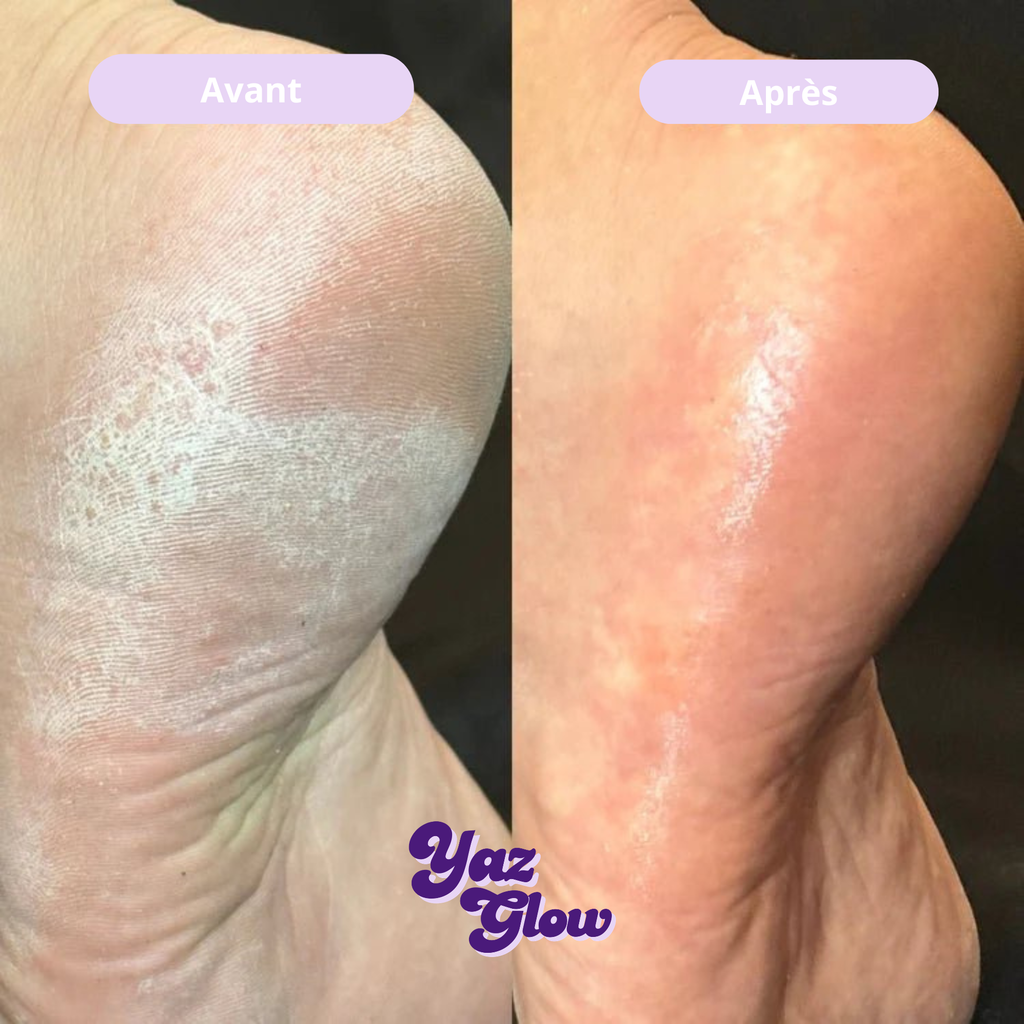 Lime à pieds en verre trempé
