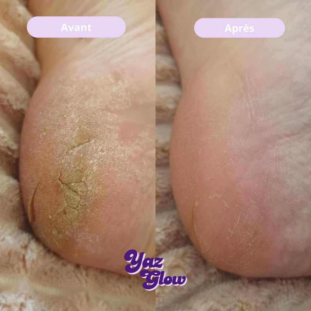 Lime à pieds en verre trempé